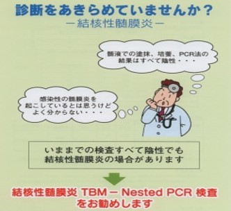 結核性髄膜炎診断法